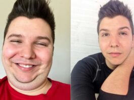 Nikocado's weight loss Journey